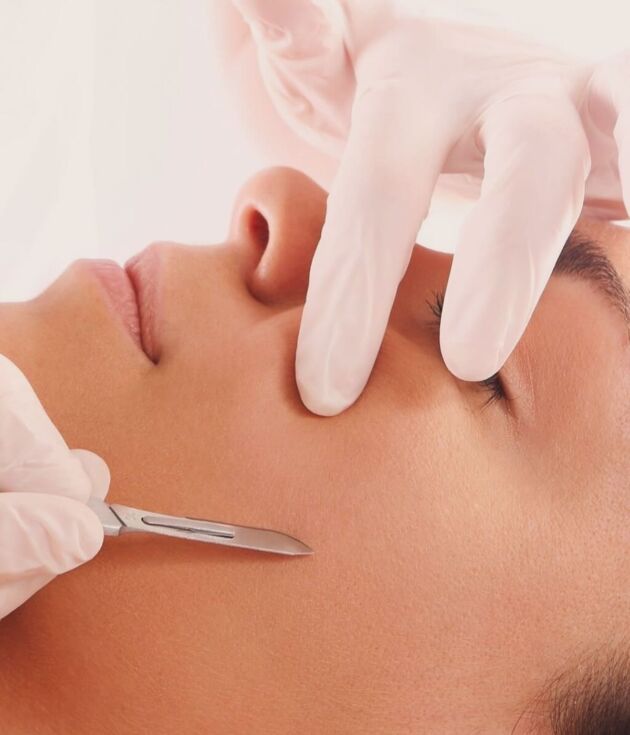 Prestation dermaplaning - Kayliss Beauty institut de beauté à Cagnes sur Mer