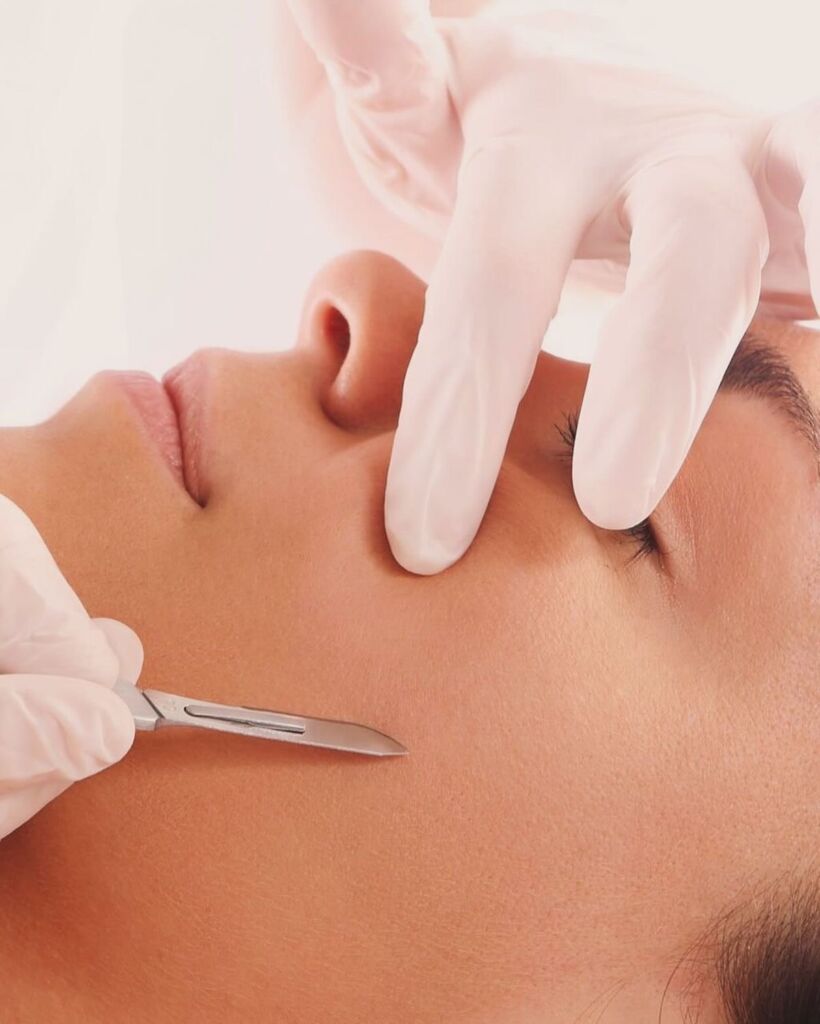 Prestation dermaplaning - Kayliss Beauty institut de beauté à Cagnes sur Mer