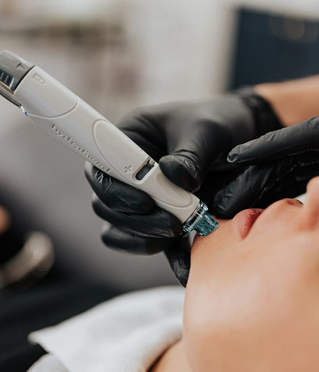 Prestation microneedling - Kayliss Beauty institut de beauté à Cagnes sur Mer